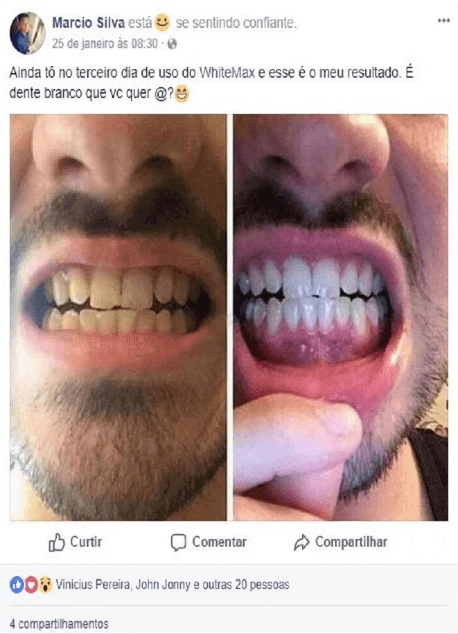 como clarear os dentes